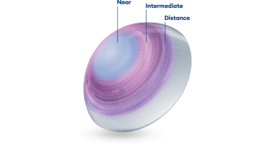 contact lens on eye ball with markers in the center for Near, middle for Intermediate, and outer edge for Distance.
