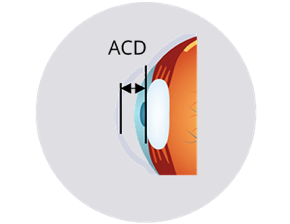 A cross-sectional illustration of an eye showing the anterior chamber depth (ACD) measurement, indicated by a double-headed arrow between the cornea and lens.
