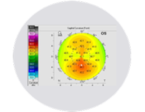 Topography corneal map of the left eye (OS) showing color-coded curvature values, with warmer colors in the center indicating steeper corneal curvature and cooler colors at the periphery.