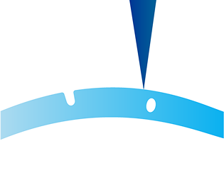 Illustration of a laser making small precise incisions in the corneal surface.