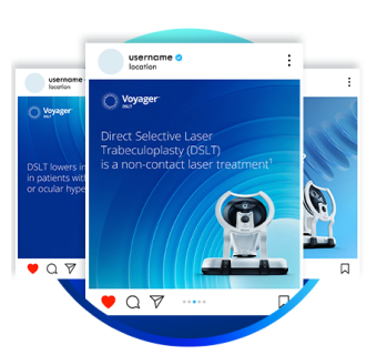 Series of Voyager DSLT social media posts featuring messaging about non-contact laser treatment for glaucoma and images of the Voyager DSLT device
