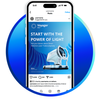 Smartphone screen displaying a social media post for Voyager DSLT with the message 'Start with the Power of Light' and an image of the glaucoma laser device