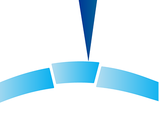 Illustration of a laser cutting out a central section of the cornea for transplant or reshaping.