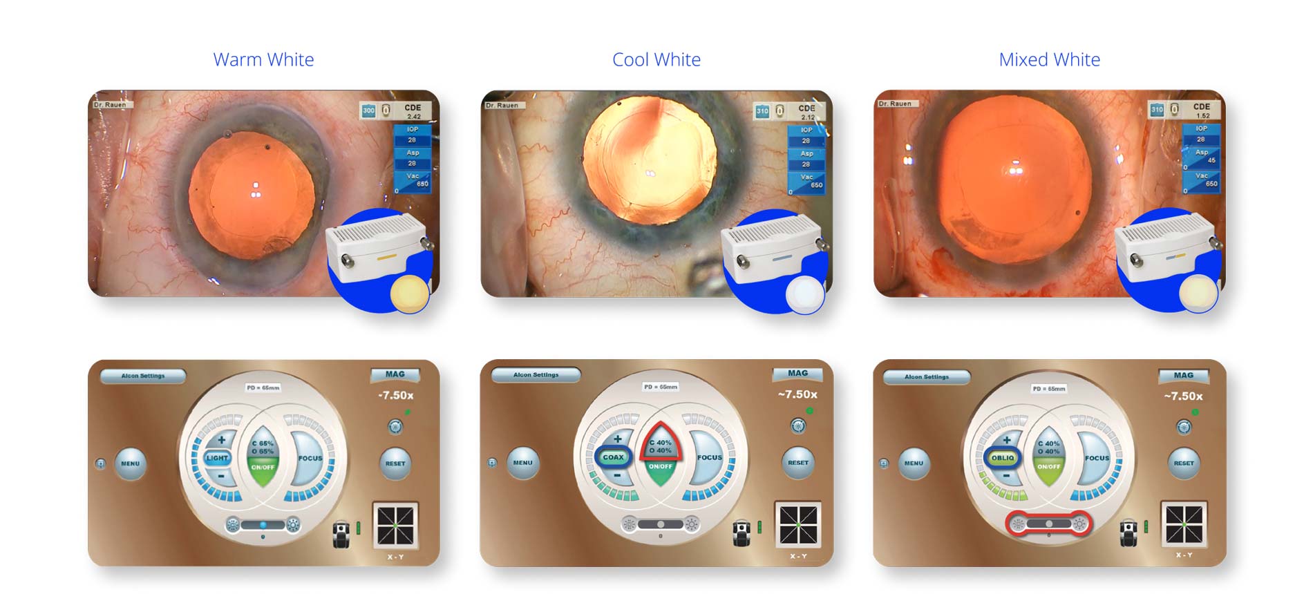 Comparison of three eye surgery views under different lighting conditions labeled Warm White, Cool White, and Mixed White, each showing a close-up of an eye with surgical instruments. Below each view is a corresponding control panel interface with circular dials and settings for illumination and focus.