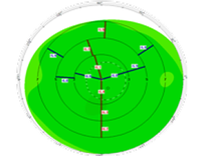 A corneal pachymetry map with green zones and numerical data, illustrating corneal thickness measurements across different regions for diagnostic analysis.