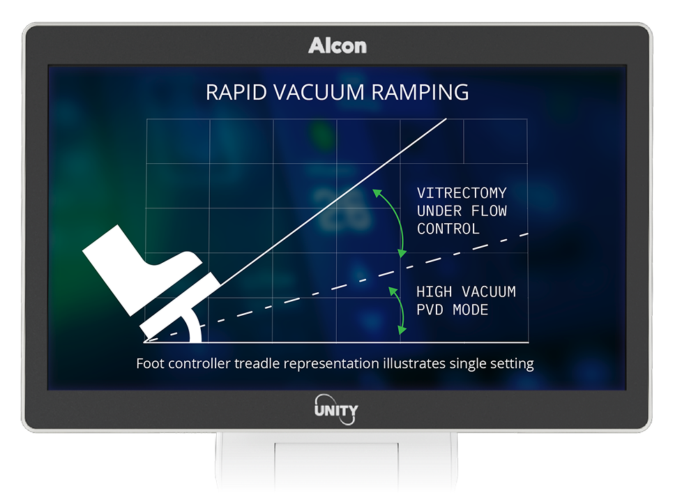 Monitor showing graph labeled “Rapid Vacuum Ramping” with foot controller icon, comparing vitrectomy under flow control and high vacuum PVD mode.