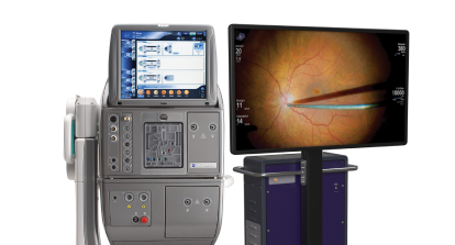 Alcon ophthalmic surgical system paired with a high-definition monitor displaying a close-up retinal procedure, showing precision instruments inside the eye.