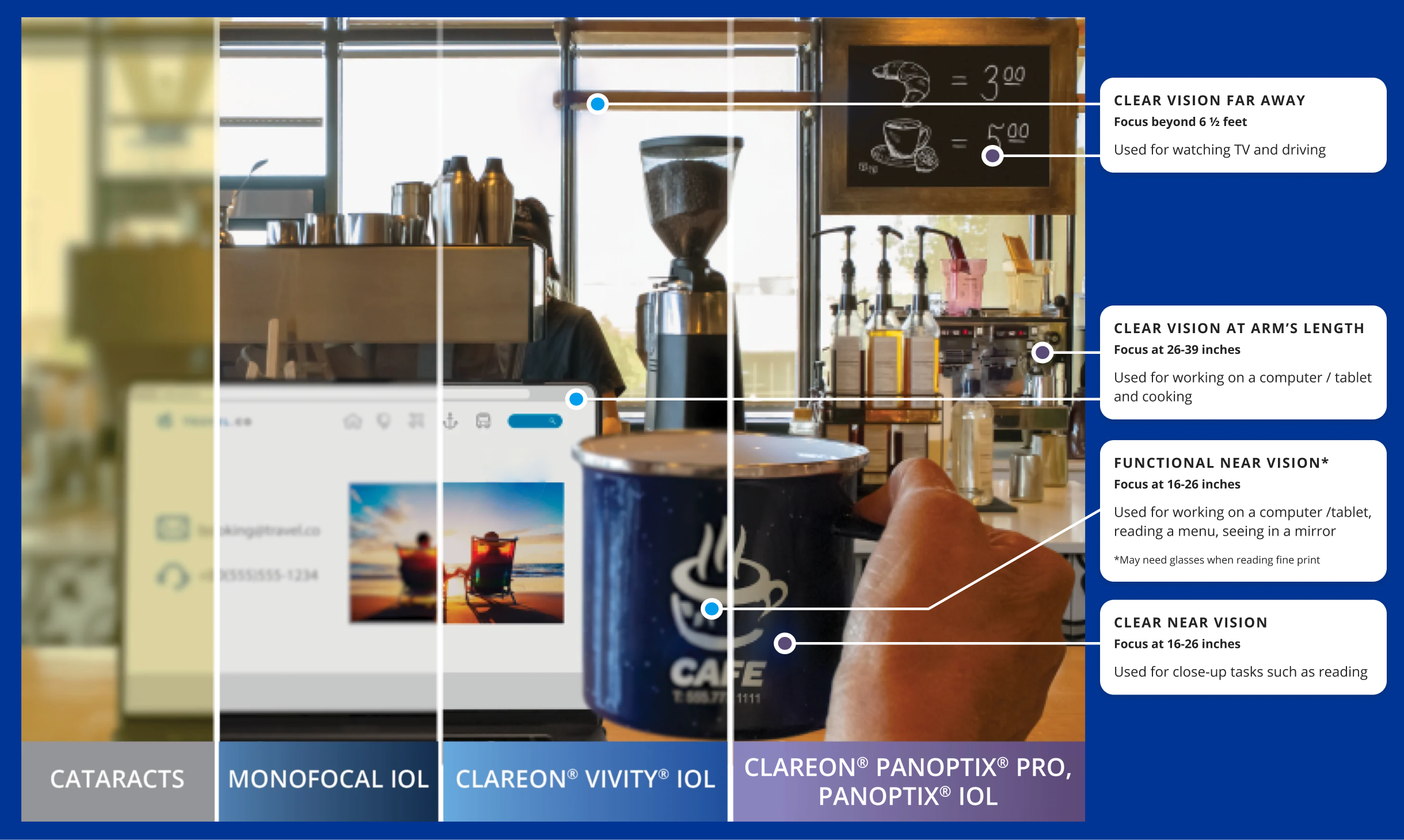 Comparison of cataracts, monofocal, Vivity, and PanOptix lenses showing differences in distance, intermediate, and near vision clarity during the daytime.