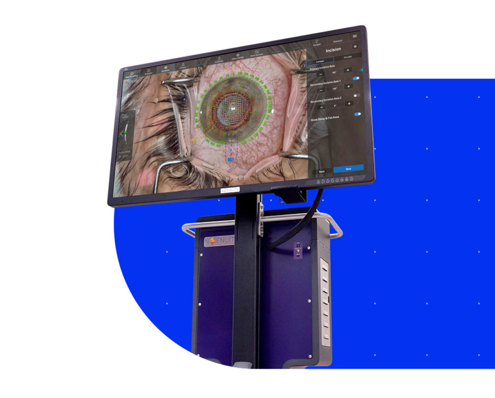 Close-up of a large monitor displaying a detailed surgical view of an eye with incision planning overlays and measurement guides. The screen is mounted on a purple medical equipment stand against a bright blue background with small white dots.