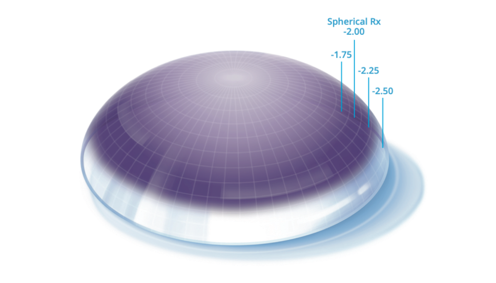 Precision profile