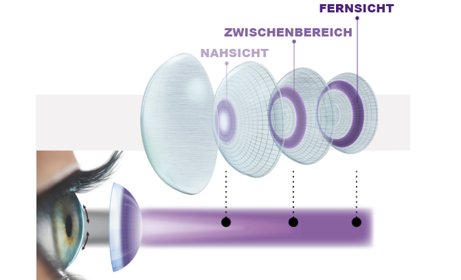 precision profile