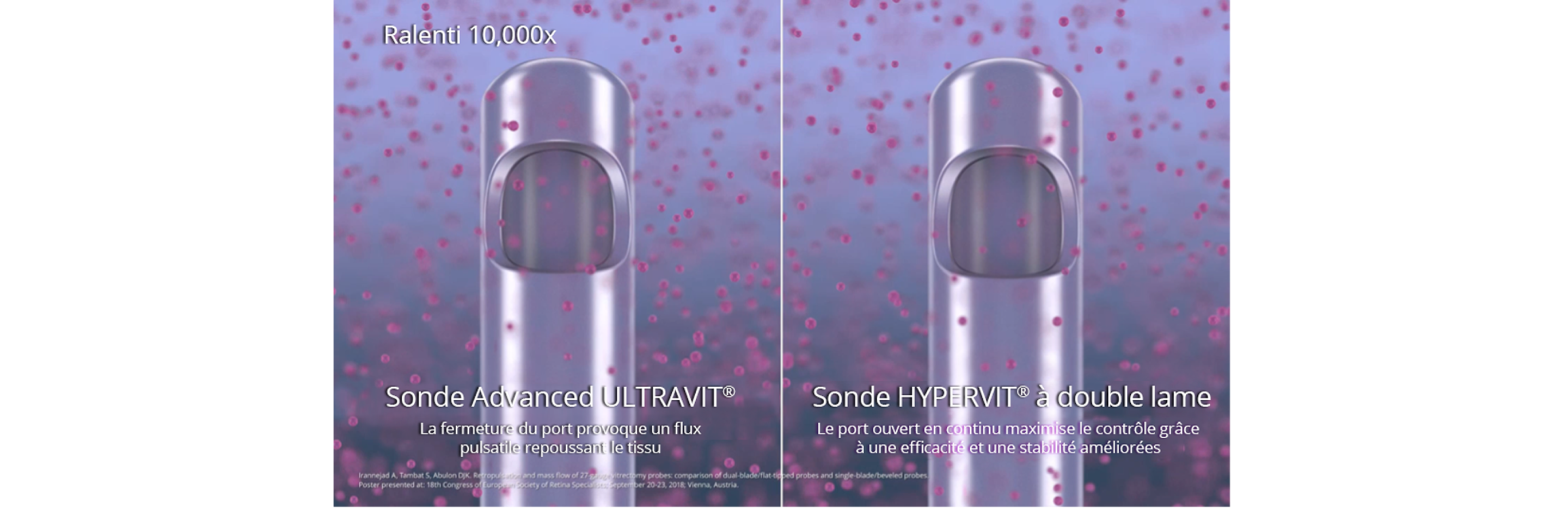 Image générée par ordinateur montrant la pointe de la sonde Advanced ULTRAVIT à gauche avec le texte suivant : "La fermeture de l'orifice provoque un flux pulsatile qui repousse les tissus", et la sonde à double lame HYPERVIT à droite avec le texte suivant : "L'orifice ouvert en permanence maximise le contrôle grâce à une efficacité et une stabilité accrues". Les sondes sont entourées d'humeur vitrée pour illustrer le flux vitré. Un bouton de lecture blanc indique qu'il s'agit d'une vidéo.