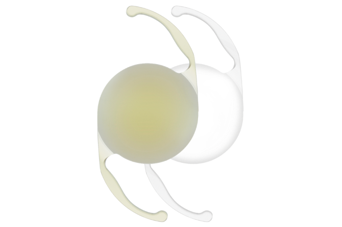 An image of two AcrySof IQ Monofocal IOLs. The IOL on the left is yellow in colour and the IOL on the right is clear.